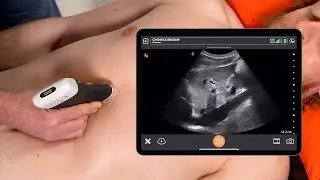 Scanning the IVC