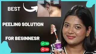 Best Peeling Solution For Beginners l How To Use Peeling Solution I&rsquo;m Right Way l Makes Skin Clear.