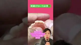 前歯に目立たない入れ歯🦷#ノンクラスプデンチャー #前歯ない #バレない #歯医者 #歯がない  #ソケット #スマイルデンチャー #歯医者 #おすすめ #保険診療 #自費治療