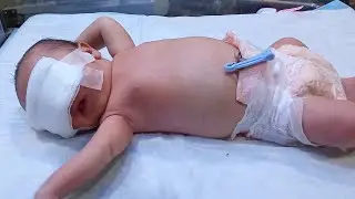 New Exchange Procedure | Newborn Baby Pampered with Clinging Care in NICU 👶💉__#Change#Dipper #baby!.