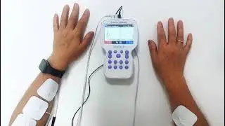 EMG Biofeedback Rehabilitation Device