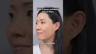 Boost my confidence? #acnescars