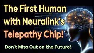Elon Musk&rsquo;s Neuralink:  Telepathy Chip implant in Human Brain #neuralink #telepathy  #elonmusk