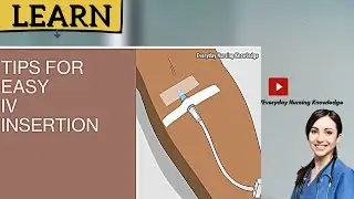 Простые советы по установке внутривенных катетеров, которые действительно работают | Быстрое нача...