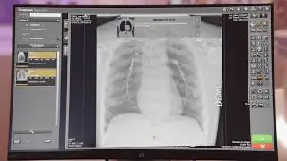 Программное обеспечение CARESTREAM Image Suite с DRX-Detector [рентгеновская визуализация]