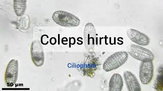 Coleps hirtus (Ciliophora)