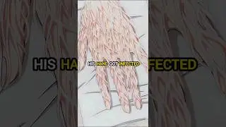 HIS HAND GOT INFECTED 😰 #anime #shorts