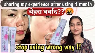 Skinlite Cream Review| Skinlite Brightening Cream|2025