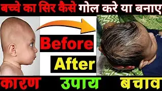 Baby Head Shape Correction/बच्चे का सिर कैसे गोल करे /बच्चे का चपटा सर गोल कैसे करें/Baby Flat Head 
