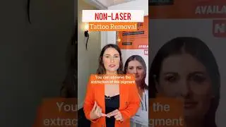 Benefit of 𝙉𝙊𝙉-𝙇𝘼𝙎𝙀𝙍 𝙏𝙖𝙩𝙩𝙤𝙤 𝙍𝙚𝙢𝙤𝙫𝙖𝙡  ✍️
