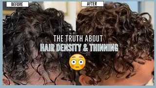The Truth About Hair Density and Thinning: What You Need to Know!