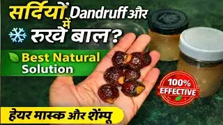 सर्दियों में डैंड्रफ और रूखे बाल?🙇 ❄️ Best Natural Hair Mask & Shampoo 🌿 WINTER SPECIAL