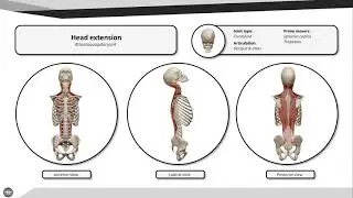 Head extension