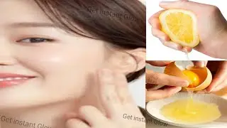 Botox Face Pack home remedy | Egg for tan removal | Body whitening | Open pores Korean remedy