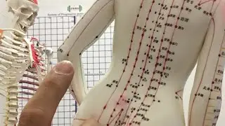 #8 Dr Tan's Balance Method Acupuncture Instant Relief Left Elbow Pain (Back Yang) on SI Meridian
