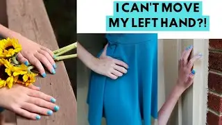 WHAT IT’S LIKE LIVING WITH ARM PARALYSIS // How my disability affects my daily life [CC]