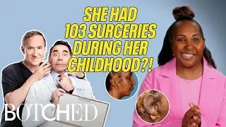 Rasheera Hears For The FIRST TIME After 103 Surgeries (Before & After) | Botched | E!