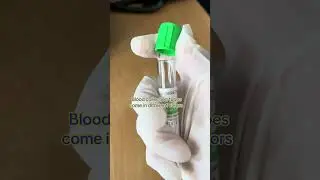 Test tubes use in lab #laboratory#music #automobile#viralshort #healthtips#lab#labtesting #diagnosis