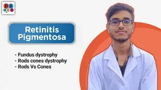 Retinitis pigmentosa | Fundus dystrophy | Rods and cones | Eye | Ophthalmology bangla lecture 