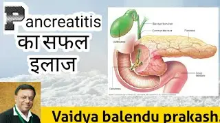 Pancreatitis || आयुर्वेद में है pancreatitis का सफल इलाज || Ayurveda physician Dr. balendu prakash