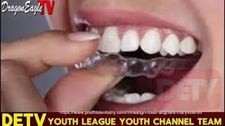 Invisalign vs Brace. What is Invisalign？ Benefits of Invisalign Ep.13｜Dragon Eagle TV Youth Channel