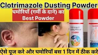 Clotrimazole dusting powder | Nuforce powder in hindi | Candid powder for baby #baby