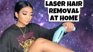 I TRIED LASER HAIR REMOVAL AT HOME, this is what happened... | DEESS