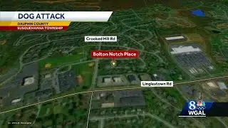 Dog attacks woman, child, then attacks officer, police say