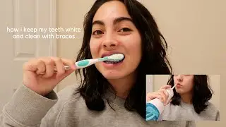 BRACES CLEANING ROUTINE :) ft. my shiny teeth and me
