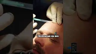 3 zones de botox pour 300&euro; ? - Clinique Paris Esth&eacute;tique 💉