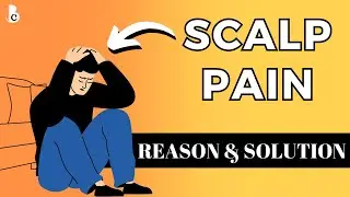 Why Does Scalp Pain? - Will Scalp Pain Cause Hair Loss? | Bearded Chokra