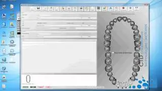 passerelle 3shape exocad cas sur wax up