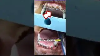Could your dog actually need braces?!