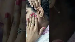 Winter Face Waxing #youtubeshorts #shortvideo #waxing