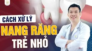 Nang Chân Răng Ở Trẻ Nhỏ - Xử Lý Thế Nào Cho An Toàn | Bác sĩ Trung Long Biên