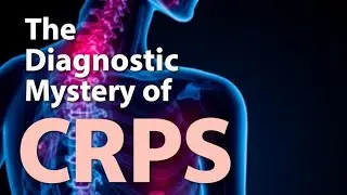 The Diagnostic Mystery of CRPS