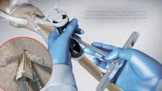 Ragdoll Medical Showreel