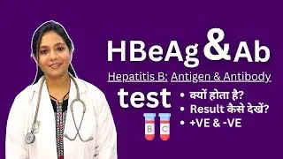 HBeAg and Antibodies Test in Hindi | Positive, Negative Result Analysis