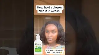 I got rid of darkspot, hyperpigmentation and dry skin on my body using Amlactin #shorts #darkspot