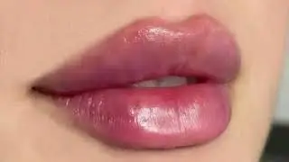 2ml lip filler- BIG PLUMPY LIPS SUBLIMINAL