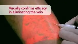 Servicom- AccuVein AV400 for Vascular Surgery