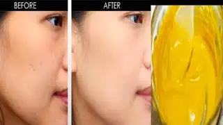 How to get Fair and Glowing skin in just 5 minutes/5मिनट मैं स्किन को दूध कि तरह गोरा करे। #Beauty