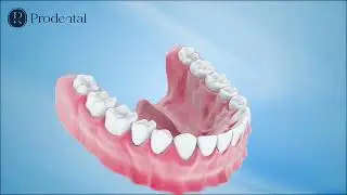 ✨ QUY TRÌNH HOÀN THIỆN RĂNG SỨ THẨM MỸ TẠI PRO DENTAL ✨