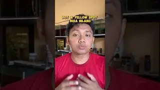 Fakta Dot dan Yellow Spot Channa Blue Pulchra #channaindonesia #channabluepulchra