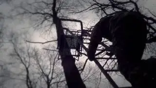 X Stands Jaw Safety System