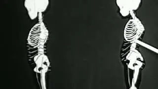 Posture Tracking Horror Stories - FIND OUT THE TRUTH!