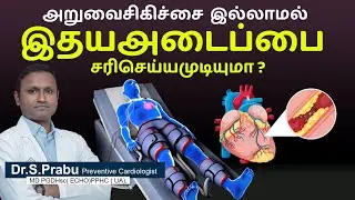 EECP - Enhanced External Counter Pulsation -அறுவை சிகிச்சை இல்லாமல் இதய அடைப்பை சரி செய்ய முடியுமா ?