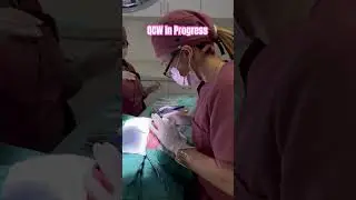 QCW in progress !! #doubleeyelidsurgery #california #medicalspa #skincare #doctor #qcw