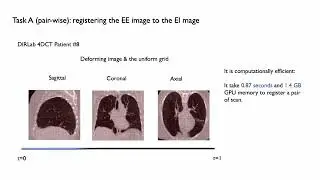 An ODE-based Recursive Registration Network for Deformable Respiratory Motion Estimation