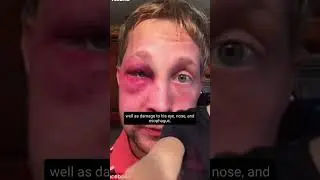 Его избили за это&hellip; #шорты